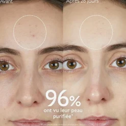 Gelée Nettoyante à l'Acide Salicylique Purifiante - 75mL