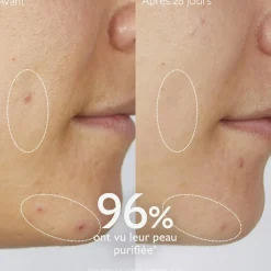 Gelée Nettoyante à l'Acide Salicylique Purifiante - 150mL