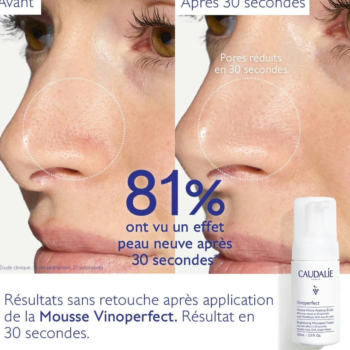 Mousse Micro-Peeling Éclat à l'Acide Mandélique (AHA) - 100ml