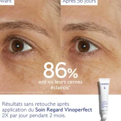 Soin Éclaircissant Regard Anti-Cernes à la Caféine et Niacinamide