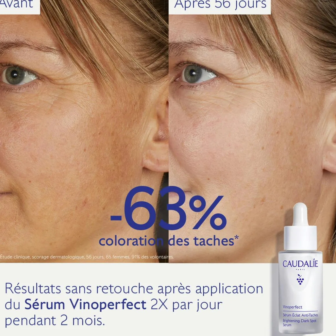 Sérum Éclat Anti-Taches à la Viniférine, alternative à la Vitamine C - 30ml