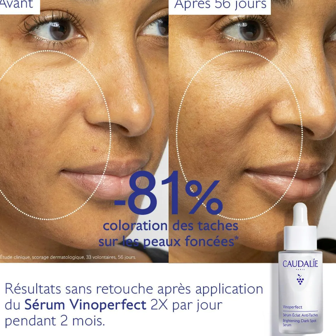 Sérum Éclat Anti-Taches à la Viniférine, alternative à la Vitamine C - 30ml