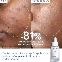 Sérum Éclat Anti-Taches à la Viniférine, alternative à la Vitamine C - 30ml