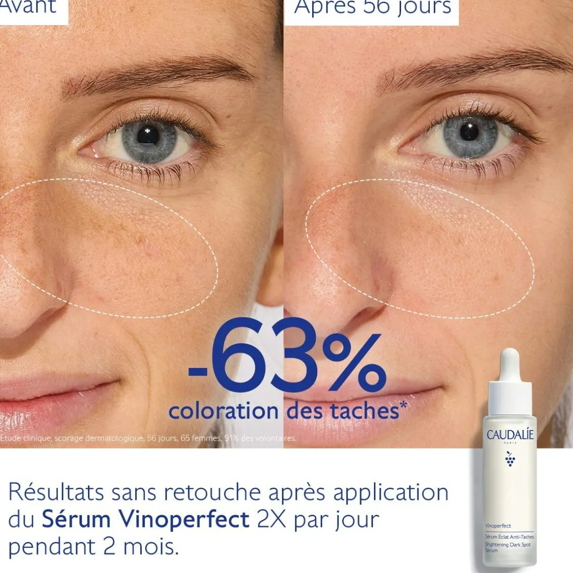 Sérum Éclat Anti-Taches à la Viniférine, alternative à la Vitamine C - Grand Format