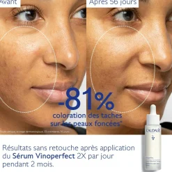 Sérum Éclat Anti-Taches à la Viniférine, alternative à la Vitamine C - Grand Format