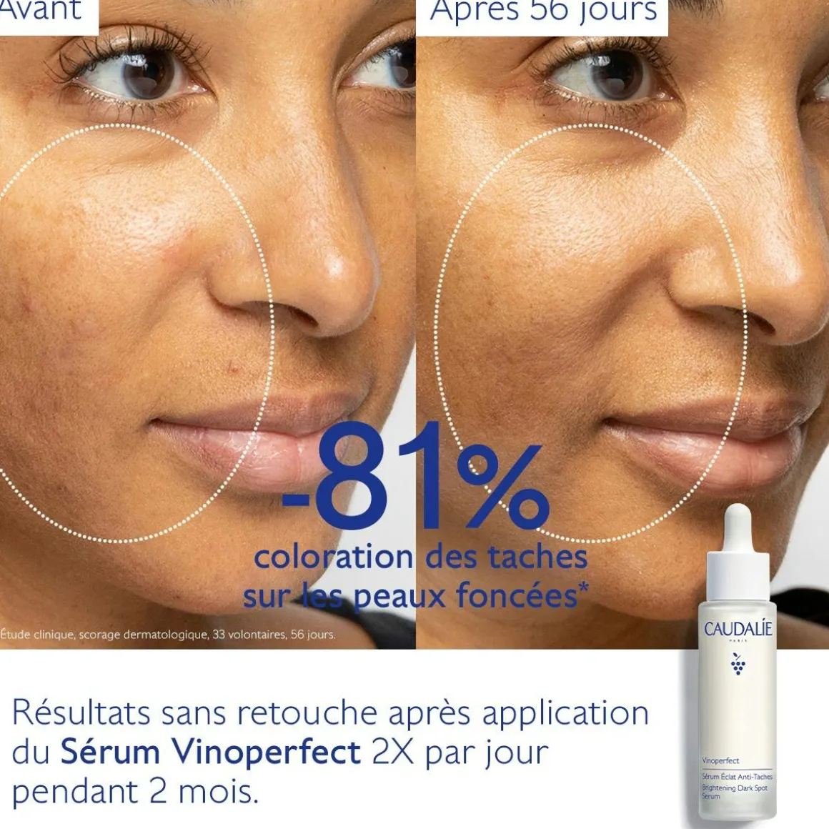 Sérum Éclat Anti-Taches à la Viniférine, alternative à la Vitamine C - Grand Format